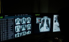 qure-chestsolution-medical-imaging-medical-scan