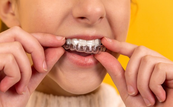 dental-dentist-surgery-teeth dental-dentist-surgery-teeth