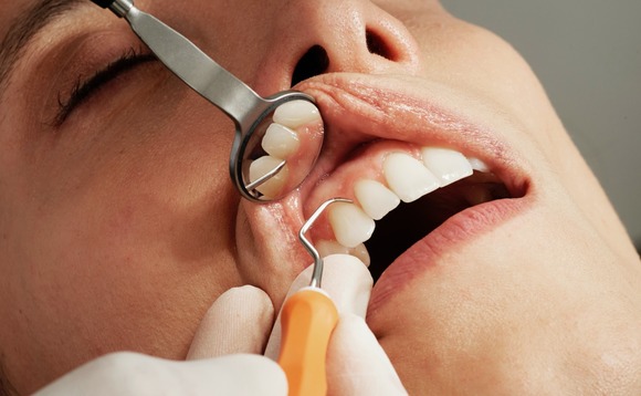 dental-dentist-surgery-teeth-mouth