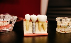 dental-dentist-teeth