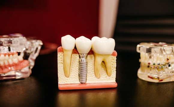 dental-dentist-teeth dental-dentist-teeth