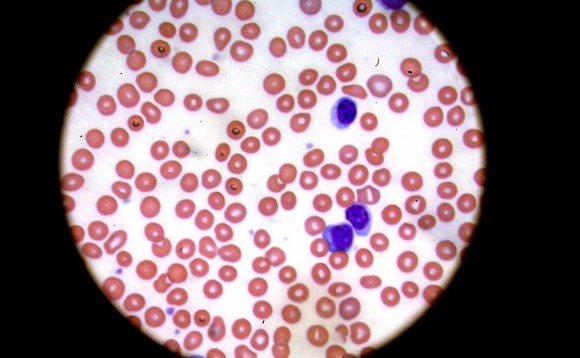 biotech-research-laboratory-cancer biotech-research-laboratory-cancer