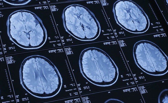 brain-mri-healthcare brain-mri-healthcare