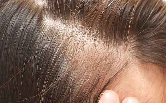 hair-thin hair-thin