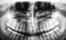 dental-image-scan