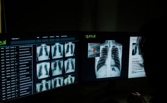 qure-chestsolution-medical-imaging-medical-scan qure-chestsolution-medical-imaging-medical-scan